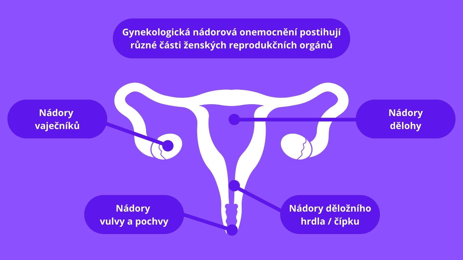 Obr. Ženské reprodukční orgány a jejich možné onkologické postižení